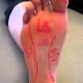 Understanding Nerve Issues on the Top of Your Foot