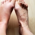 The Healing Process of Foot Inflammation: A Comprehensive Guide