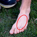 Understanding Stress Fractures in the Foot