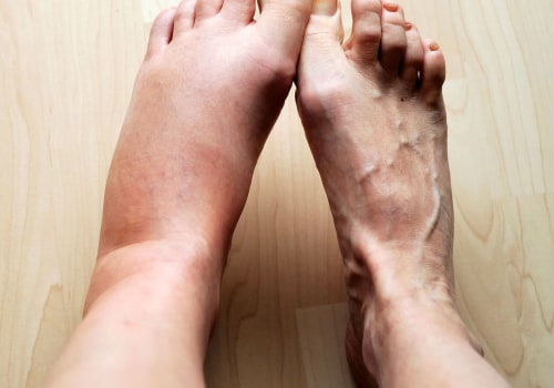 The Healing Process of Foot Inflammation: What You Need to Know