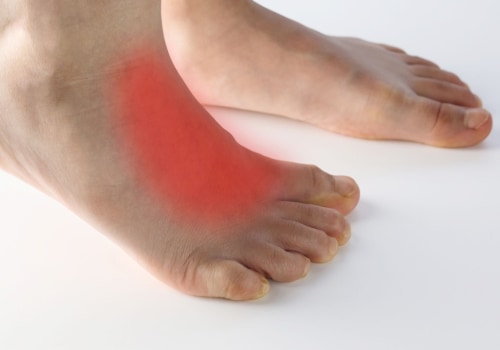 The Healing Process of Tendonitis on Top of the Foot