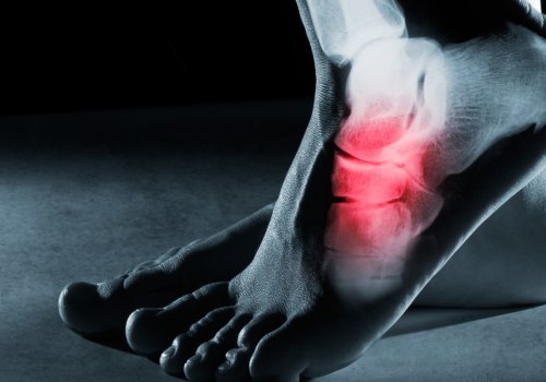 Understanding the Causes of Inflammation on the Top of the Foot