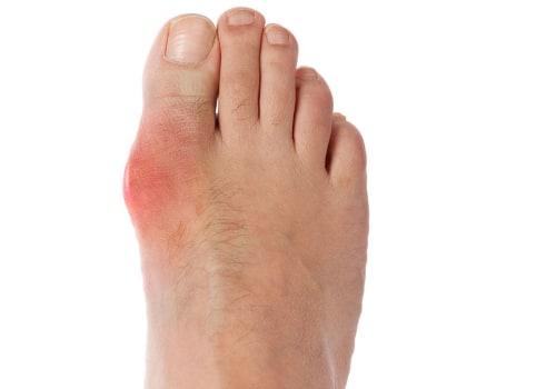 The Surprising Connection Between Foot Pain and Heart Problems