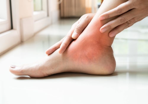 Expert Tips for Treating Inflammation on the Top of Your Foot